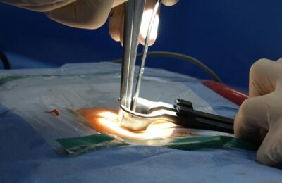 Calvar medical – 4 operatii de hernie, durerea persista. Ce au descoperit medicii, in final