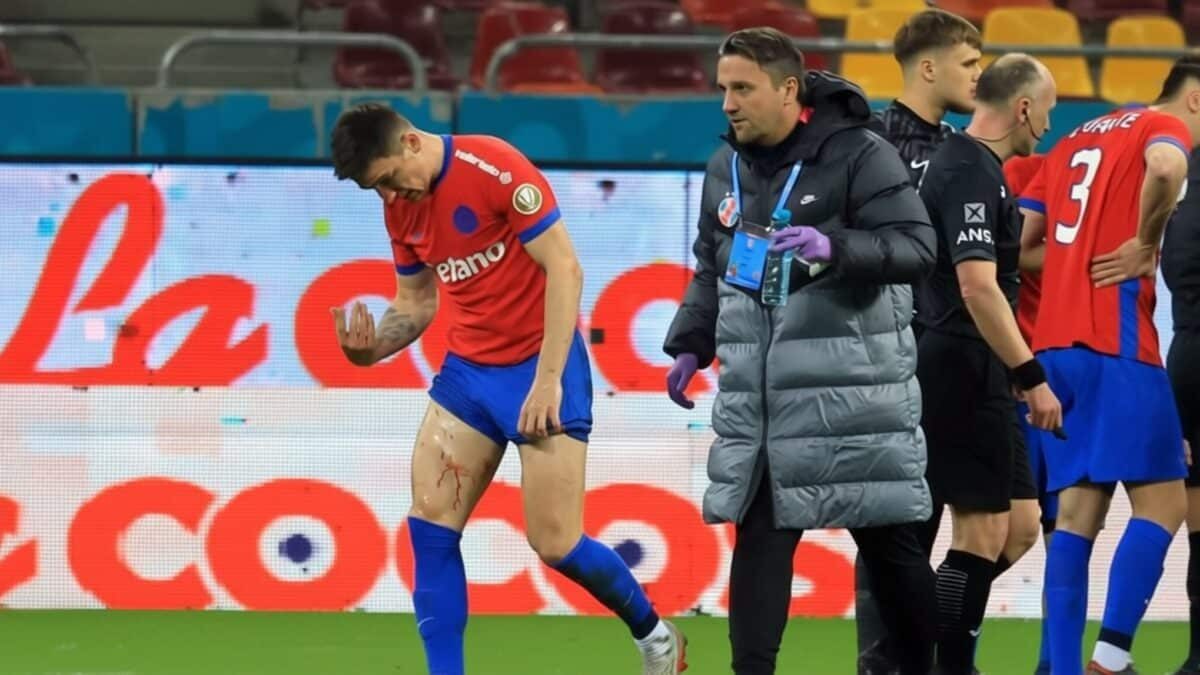 FCSB pierde doi titulari după egalul cu Metaloglobus