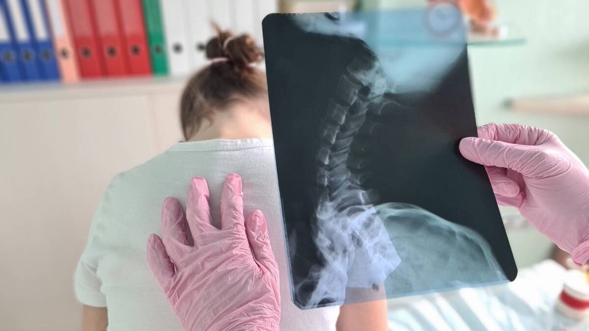 Un sfert dintre copii acuză dureri de spate. Fizioterapeutul explică riscurile