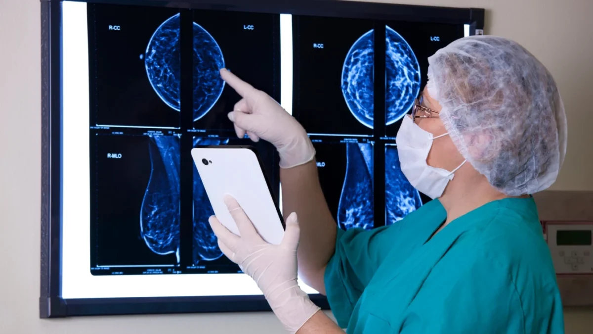 Sânii denși cresc riscul de cancer mamar la 15% pentru 40% dintre femei